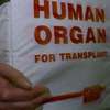 Украина бьёт рекорды по числу предложений о продаже внутренних органов